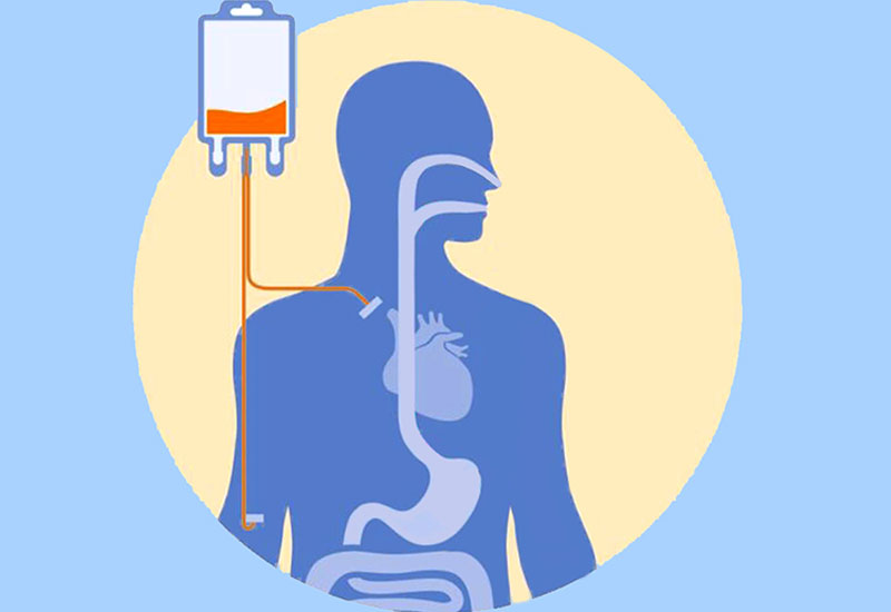 Parenteral_Nutrition Approach to Parenteral Nutrition